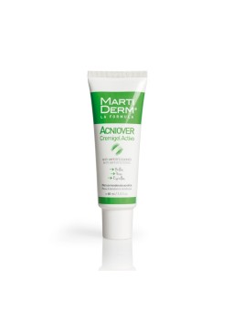 Martiderm acniover...